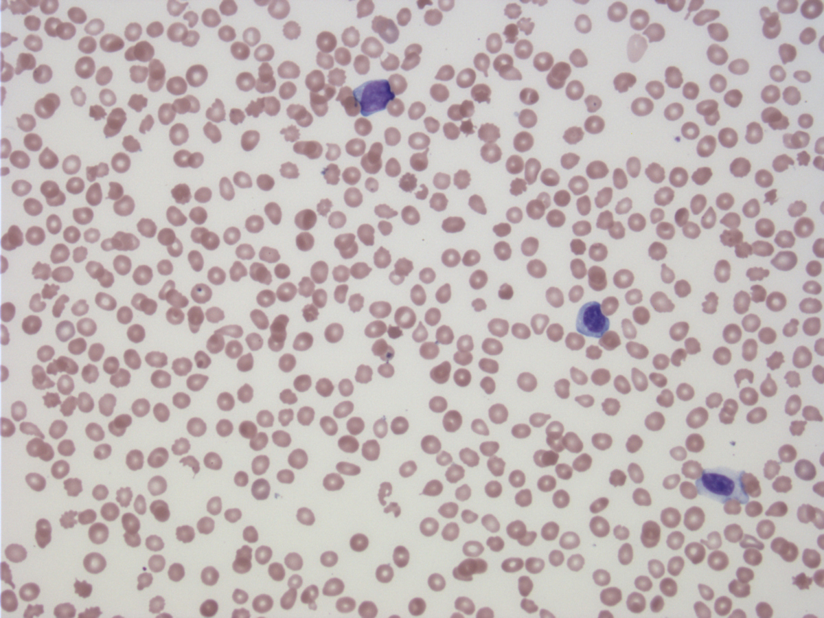Blood smear (BM-3), Wright-Giemsa stain, x400 